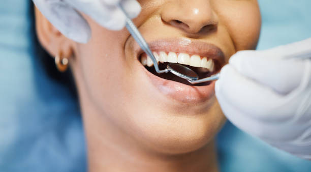 Best Urgent Tooth Repair  in Piqua, OH
