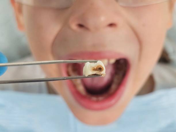 Best Tooth Pain Emergency Relief  in Piqua, OH