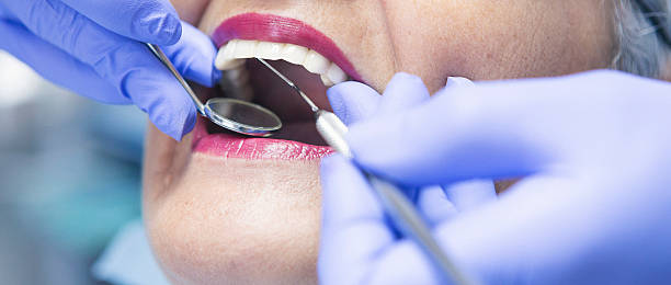Best Root Canal Emergency Dentist  in Piqua, OH