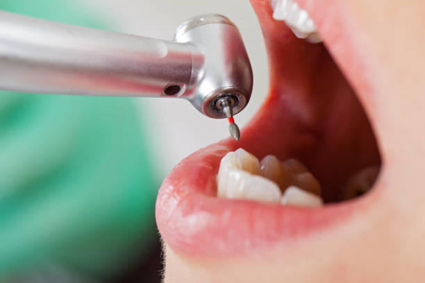 Best Cracked Tooth Emergency Dentist  in Piqua, OH